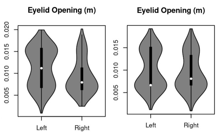 Left: Example of a violin plot showing that the reader has more data points with larger eyelid apertures in the first two hours of reading than in the last two hours. Right: Violin plot of a participant
