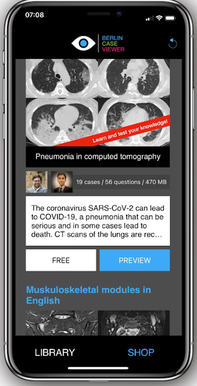 Users can scroll through the full CT dataset per case and access the clinical history available before deciding on diagnosis