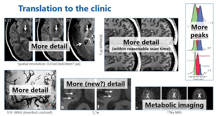 How the MRI advantages translate to the clinic