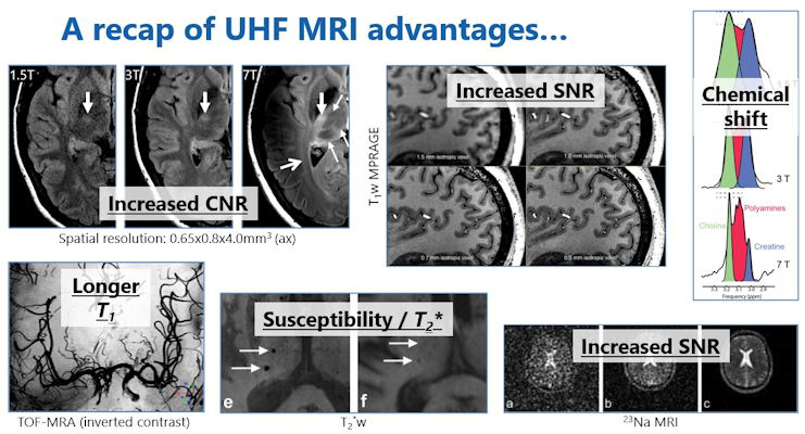 A summary of the main advantages of ultrahigh-field MRI