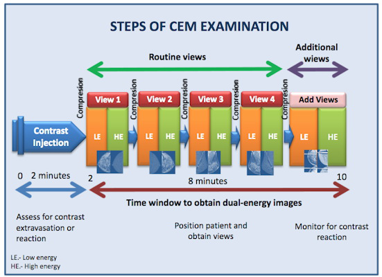 The graphic illustrates the various stages of the CEM examination