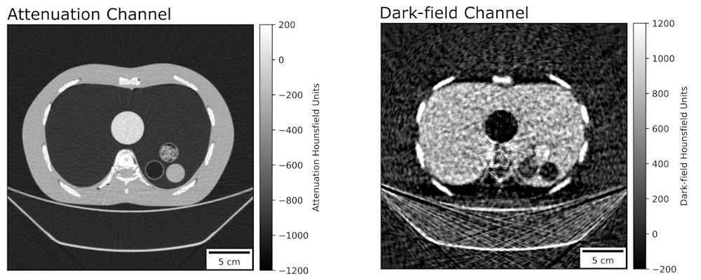 Dark-field CT reconstruction of a clinical chest phantom