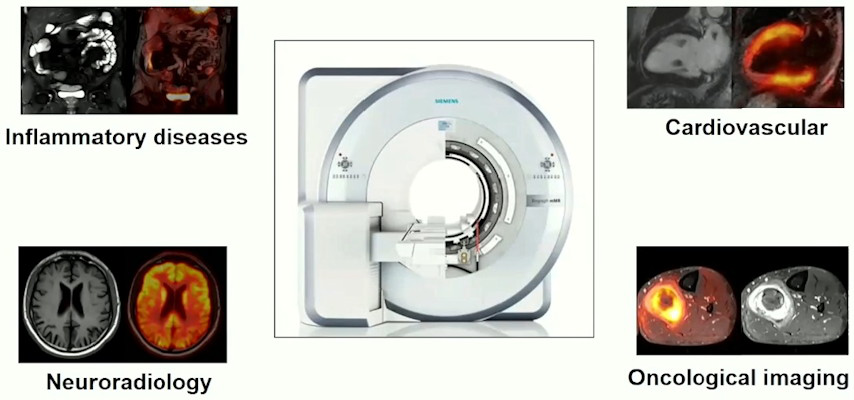 The Big Four clinical application fields of PET MRI