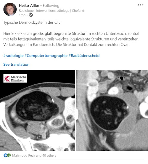 Interventional radiology image shared on LinkedIn