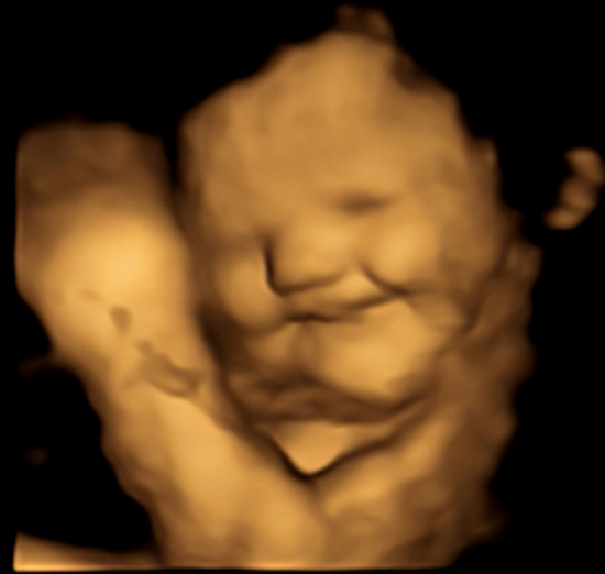 Researchers from Durham University examined fetal reactions to flavor capsules ingested by their mothers via 4D ultrasound