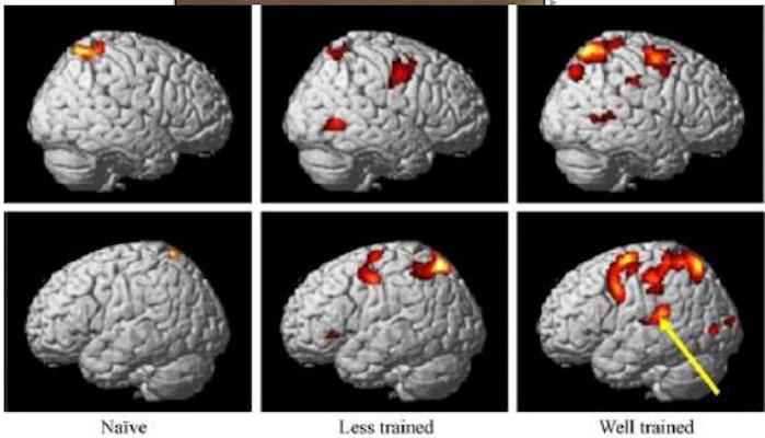 Bottom left shows brain areas activated by just looking at a pianist playing a musical piece