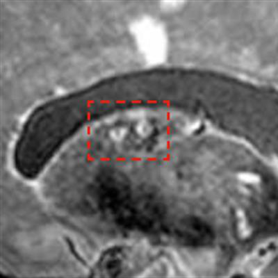 Is 7-tesla MRI ready yet to go clinical?