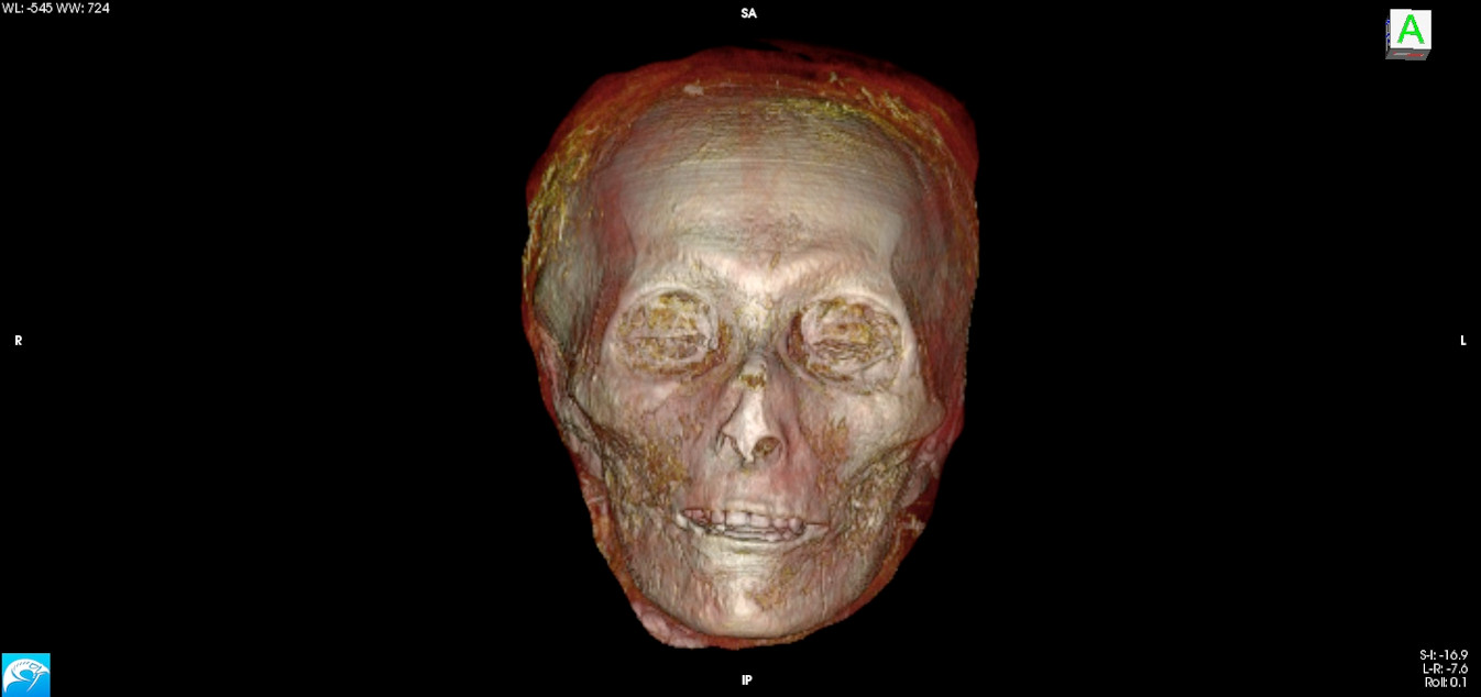  3D CT image of the skull of Amenhotep I.
