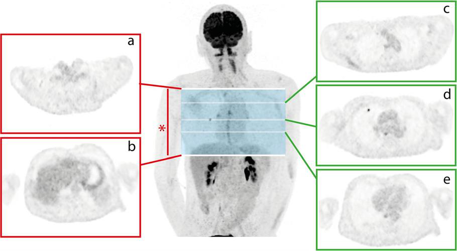 Illustration showing the annotation of PET images for training and testing of the deep-learning algorithm