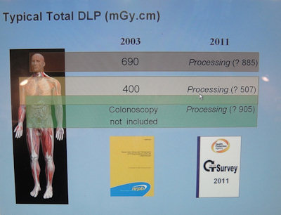 typical total DLP data
