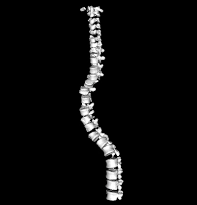 Reconstructed CT spine image