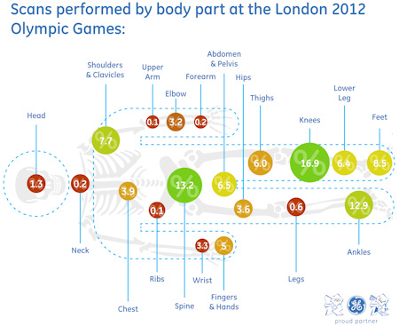 Scans per body part at London 2012 Olympics